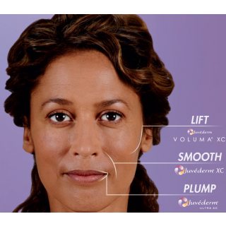Juvederm Ultra Plus XC - Lip Filler (1mL syringe)