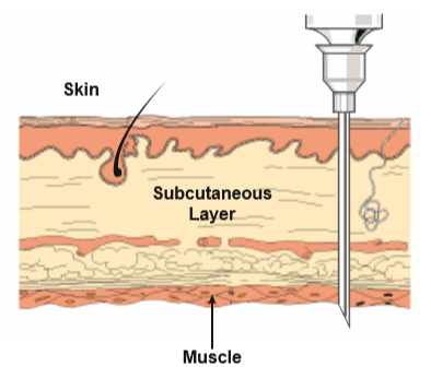 IM injection technique