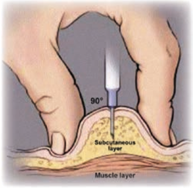 SC injection technique